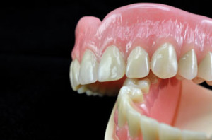 Full-Acrylic-Denture-2