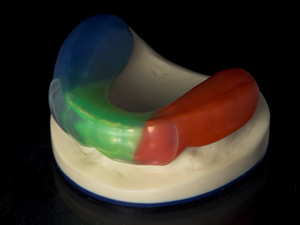 professional_mouthguard